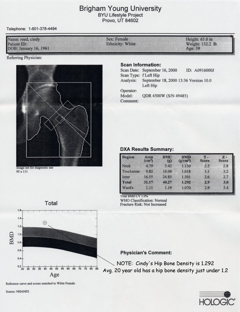 Bone density of 1.292 at age 39, which is better than the 1.197 average hip bone density of 20-year old womens' hips