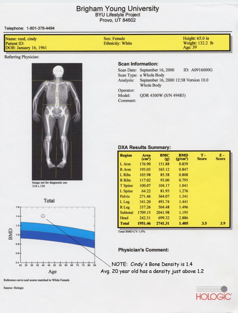 Bone density of 1.405 at age 39 is better than the average 20 year old woman's bone density of 1.27